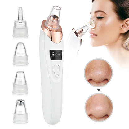 5-in-1 Rechargeable Blackhead Remover & Pore Cleaner Vacuum