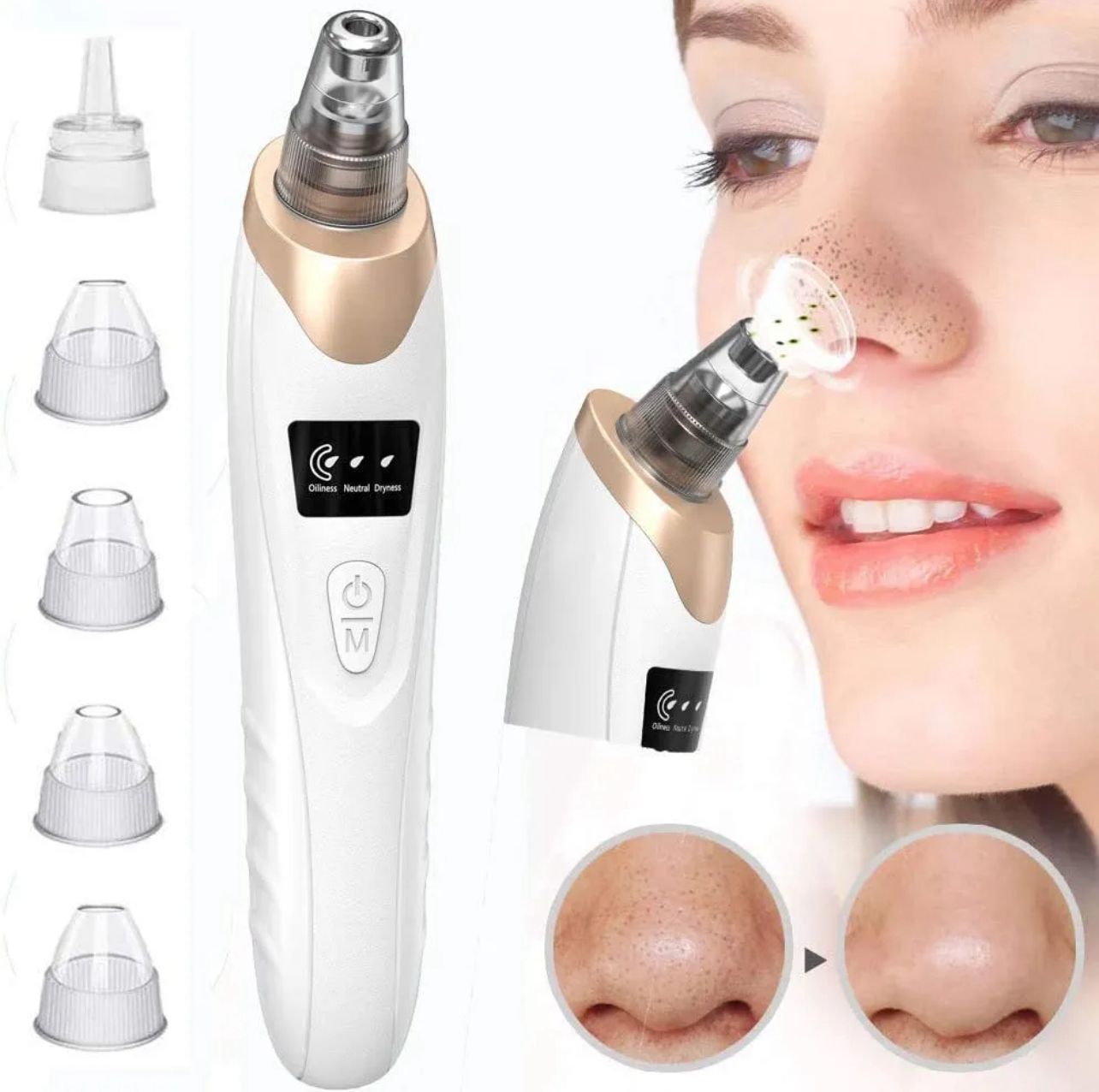 5-in-1 Rechargeable Blackhead Remover & Pore Cleaner Vacuum
